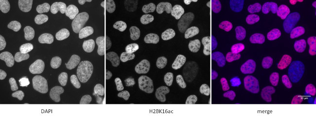 Histone H2BK16ac Antibody in Immunocytochemistry (ICC/IF)