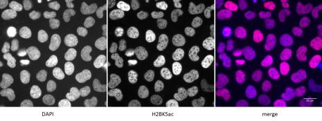 Histone H2BK5ac Antibody in Immunocytochemistry (ICC/IF)