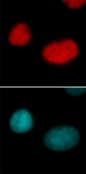 Histone H3K18ac Antibody in Immunocytochemistry (ICC/IF)