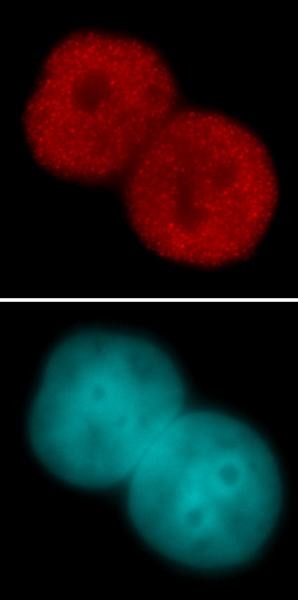 Histone H3K23ac Antibody in Immunocytochemistry (ICC/IF)