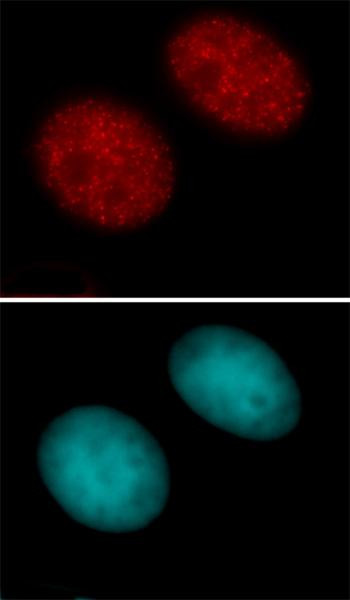 Histone H3K27ac Antibody in Immunocytochemistry (ICC/IF)