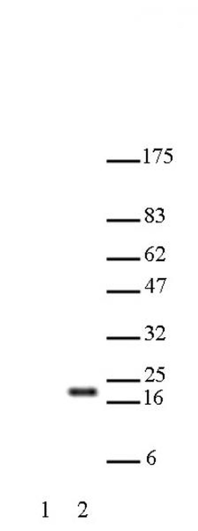 Histone H3K27ac Antibody in Western Blot (WB)