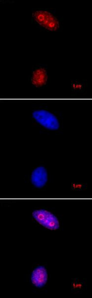 Histone H3K27me3 Antibody in Immunocytochemistry (ICC/IF)