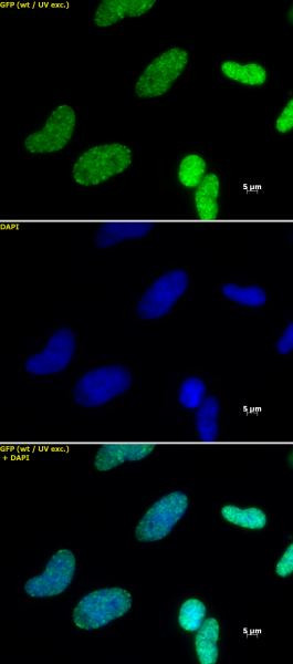 Histone H3K27me3 Antibody in Immunocytochemistry (ICC/IF)