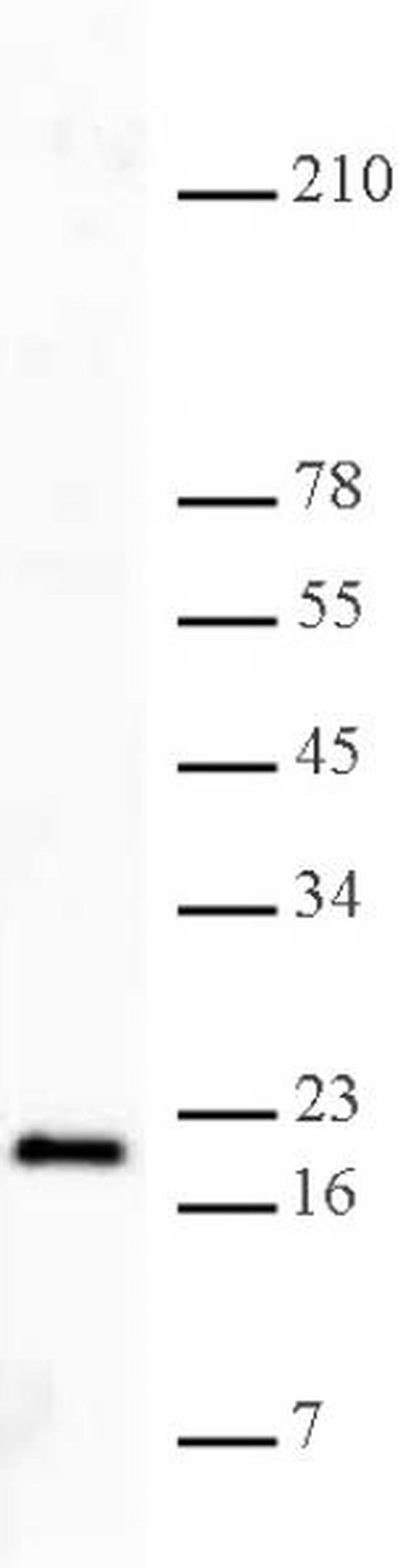 Histone H3K27me3 Antibody in Western Blot (WB)