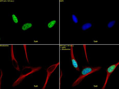 Histone H3K4me3 Antibody in Immunocytochemistry (ICC/IF)