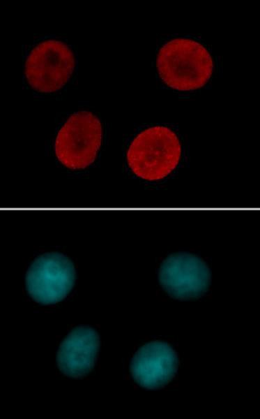 Histone H4K12ac Antibody in Immunocytochemistry (ICC/IF)