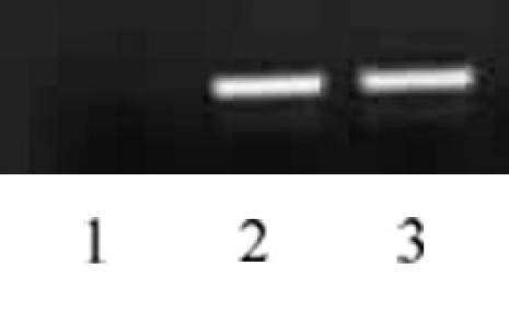 Histone H4K5ac Antibody in ChIP Assay (ChIP)