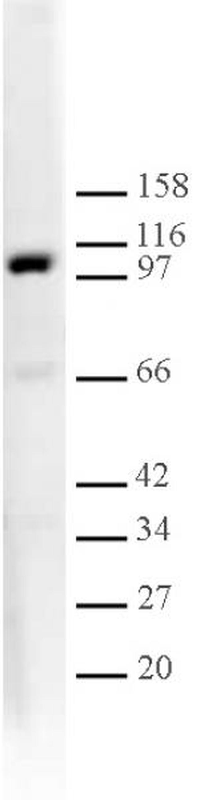 L3MBTL1 Antibody in Western Blot (WB)