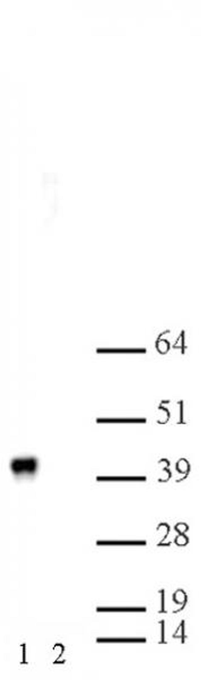 MEP50 Antibody in Western Blot (WB)