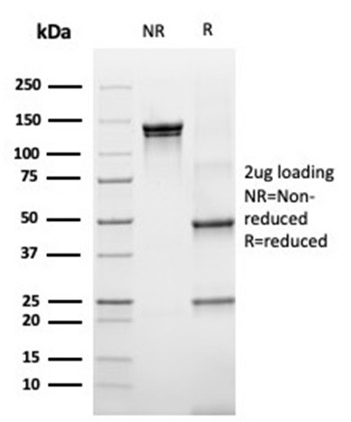 Laminin Receptor/ RPSA (Marker of Metastatic Potential) Antibody in SDS-PAGE (SDS-PAGE)