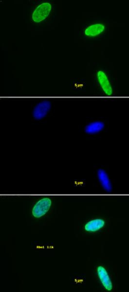 Histone H3K9me2 Antibody in Immunocytochemistry (ICC/IF)