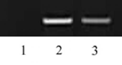 Histone H3K27me2 Antibody in Immunocytochemistry (ICC/IF)