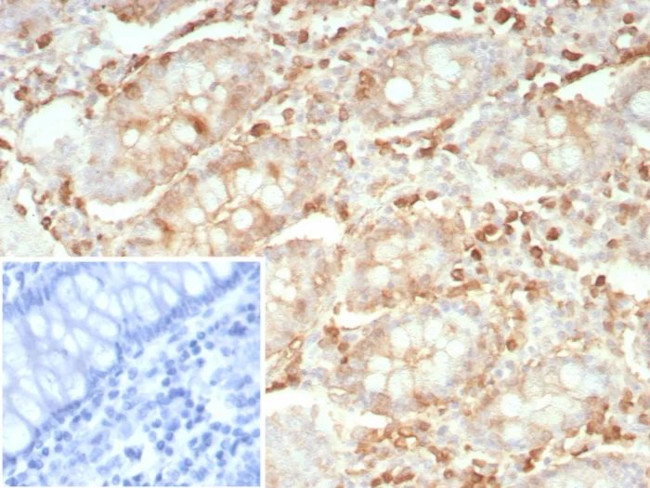 Stathmin 1/STMN1 Antibody in Immunohistochemistry (Paraffin) (IHC (P))