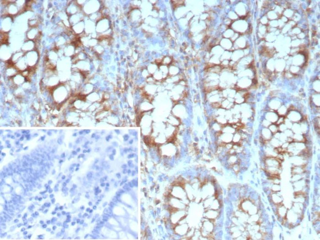 Stathmin 1/STMN1 Antibody in Immunohistochemistry (Paraffin) (IHC (P))