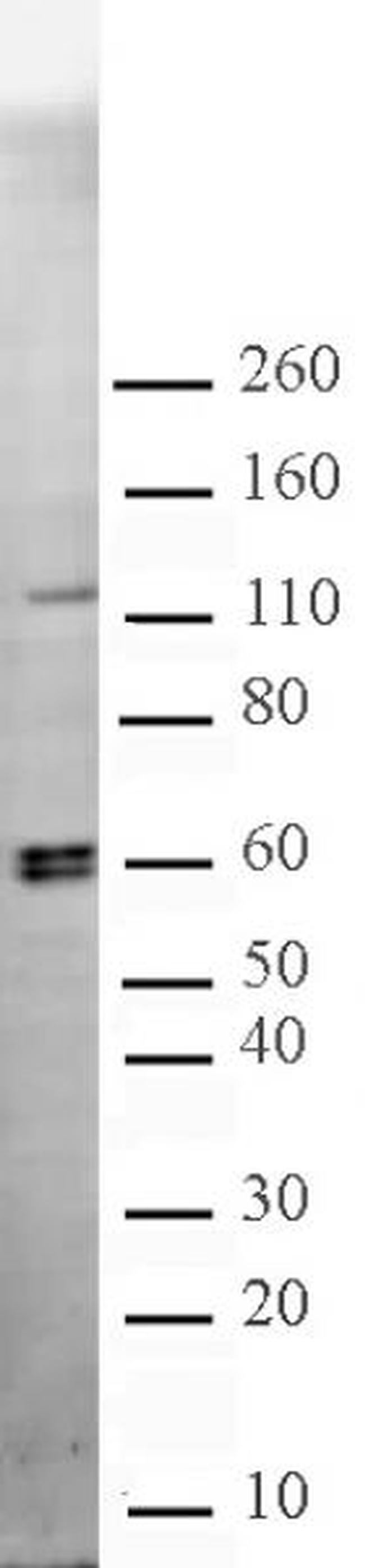 CARM1 Antibody in Western Blot (WB)