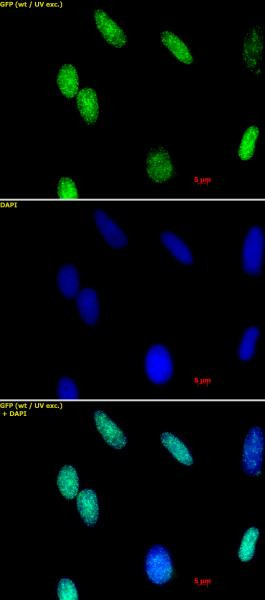 Histone H3K36me2 Antibody in Immunocytochemistry (ICC/IF)