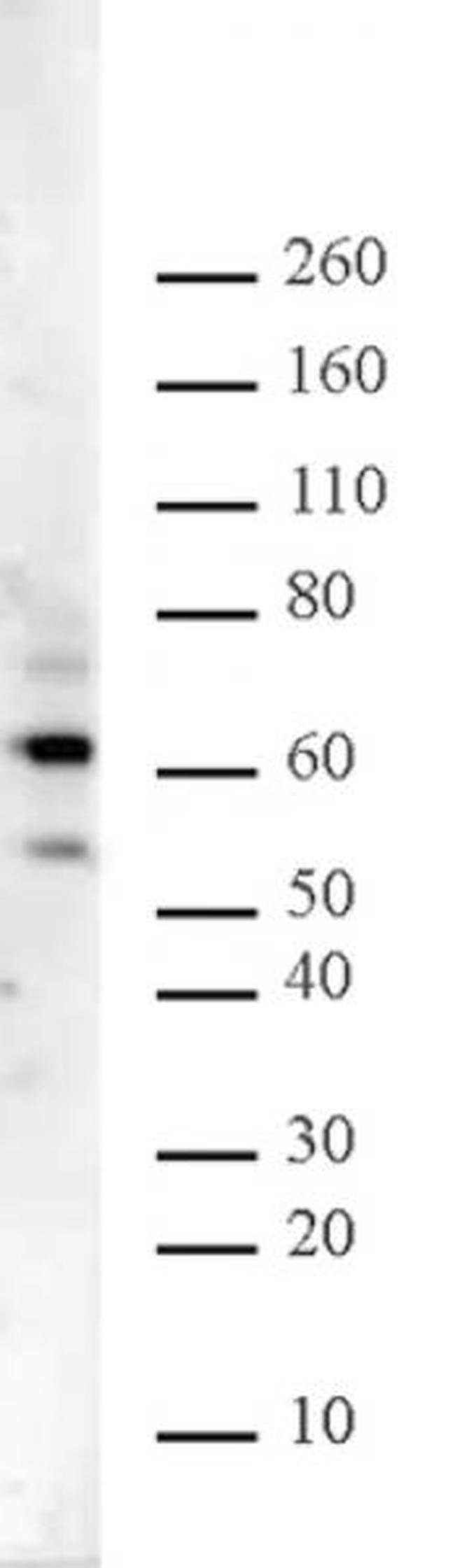 Ikaros Antibody in Western Blot (WB)