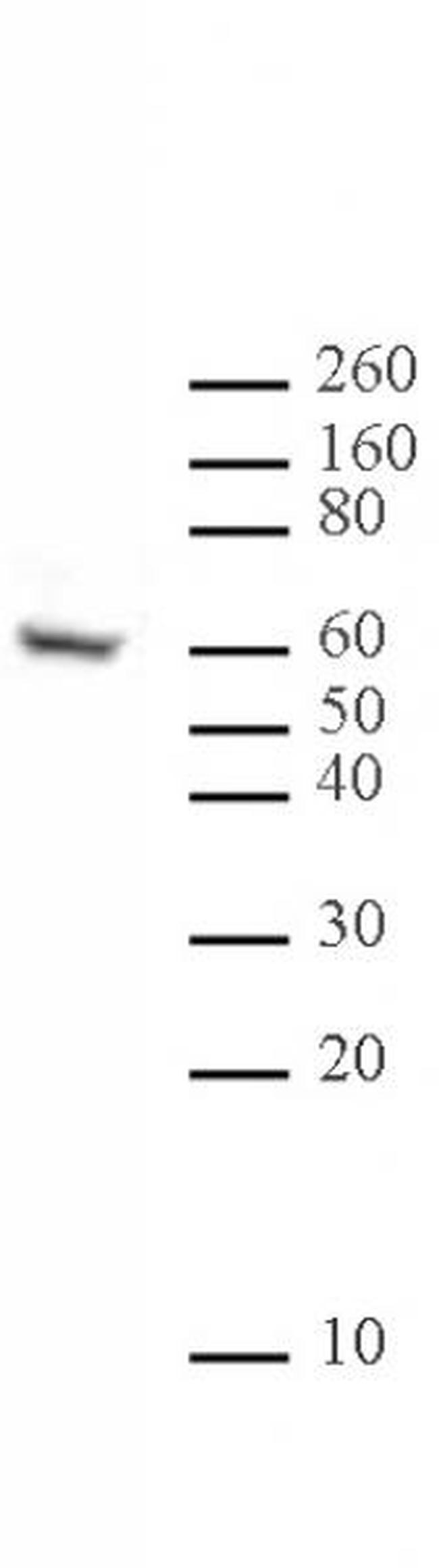 Ikaros Antibody in Western Blot (WB)