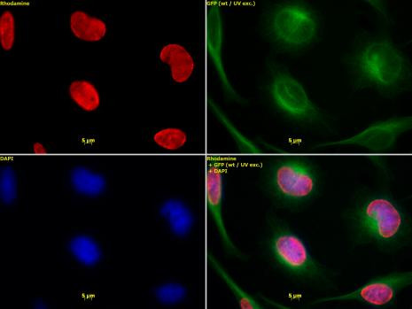 Histone H3K9me2 Antibody in Immunocytochemistry (ICC/IF)