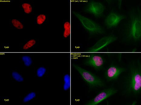 Histone H3K36ac Antibody in Immunocytochemistry (ICC/IF)