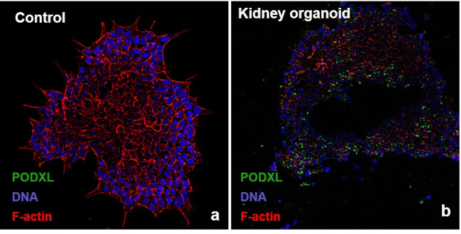 PODXL Antibody in Immunocytochemistry (ICC/IF)