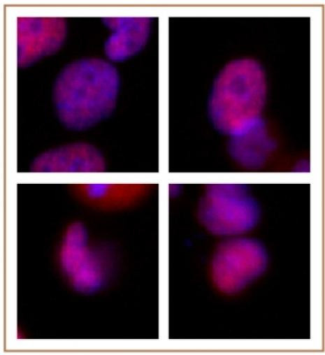 Rad21 Antibody in Immunocytochemistry (ICC/IF)