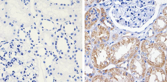 AKT2 Antibody in Immunohistochemistry (Paraffin) (IHC (P))