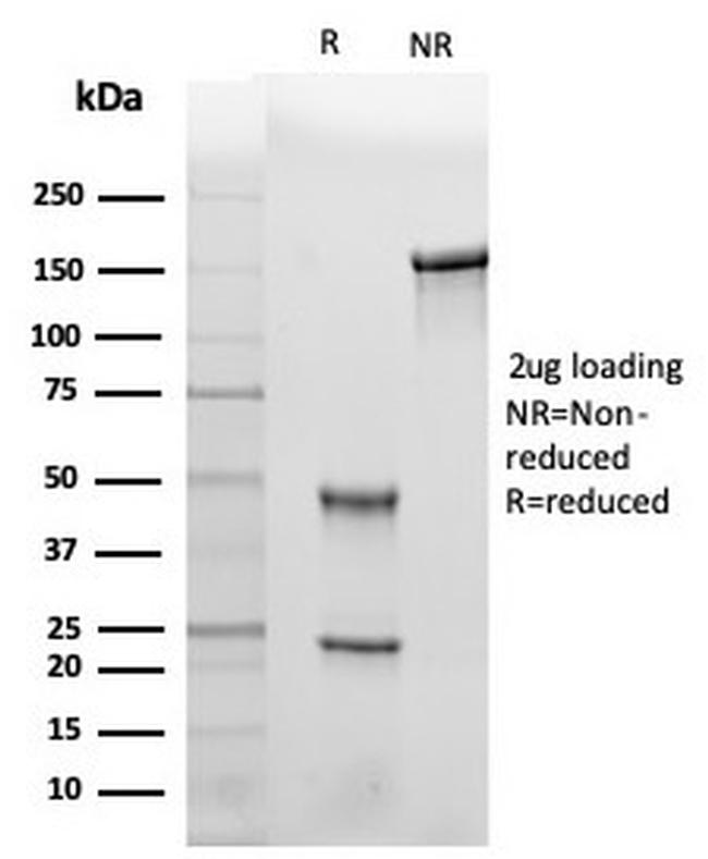 Leptin Receptor (LEPR)/Ob-R/CD295 Antibody in SDS-PAGE (SDS-PAGE)