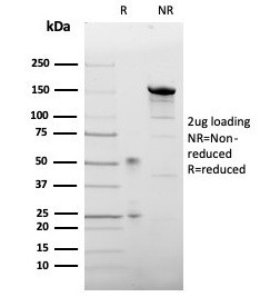 Leptin Receptor (LEPR)/Ob-R/CD295 Antibody in SDS-PAGE (SDS-PAGE)