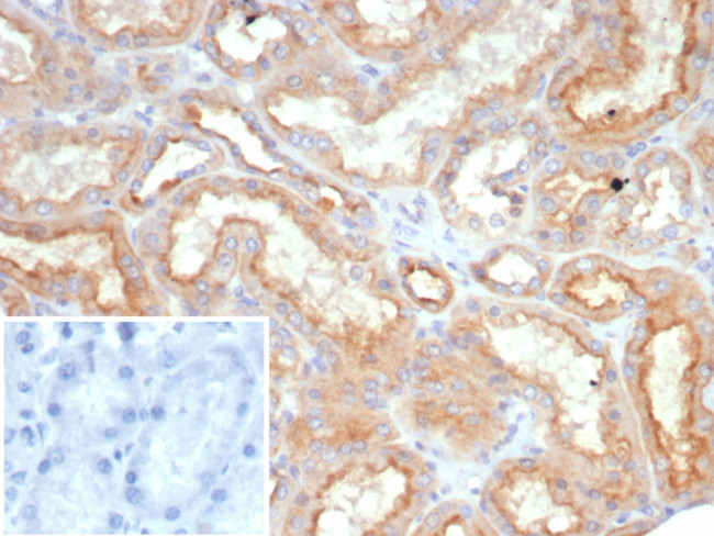 Leptin Receptor (LEPR)/Ob-R/CD295 Antibody in Immunohistochemistry (Paraffin) (IHC (P))