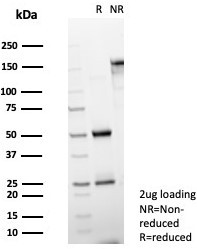 Leptin Receptor (LEPR)/Ob-R/CD295 Antibody in SDS-PAGE (SDS-PAGE)