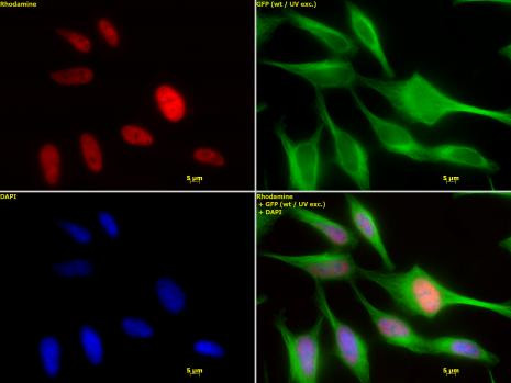 HDAC2 Antibody in Immunocytochemistry (ICC/IF)