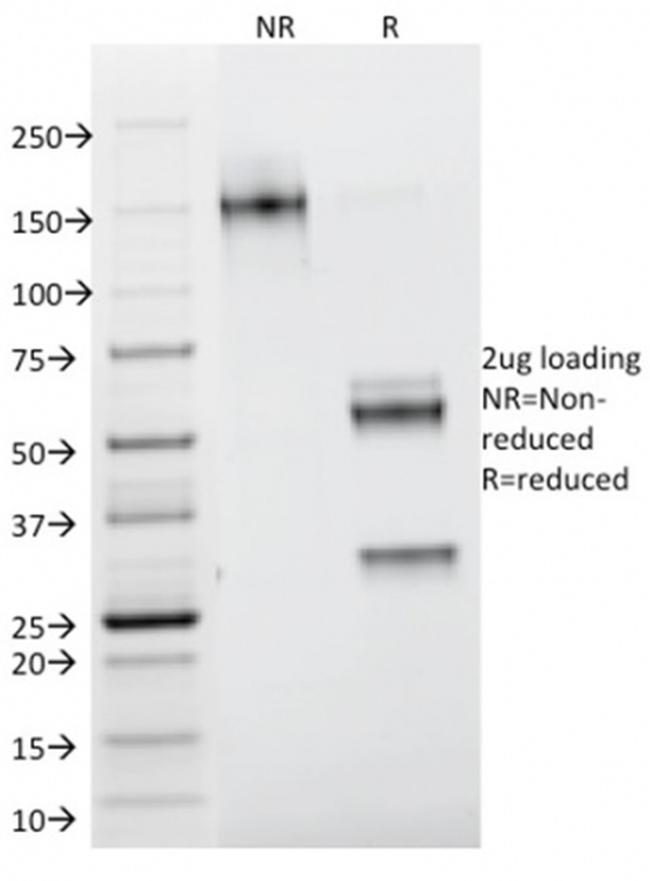 Galectin-1/Human Placental Lactogen (hPL) Antibody in SDS-PAGE (SDS-PAGE)