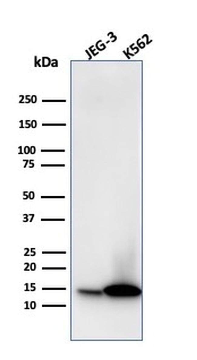 Galectin-1/Human Placental Lactogen (hPL) Antibody in Western Blot (WB)