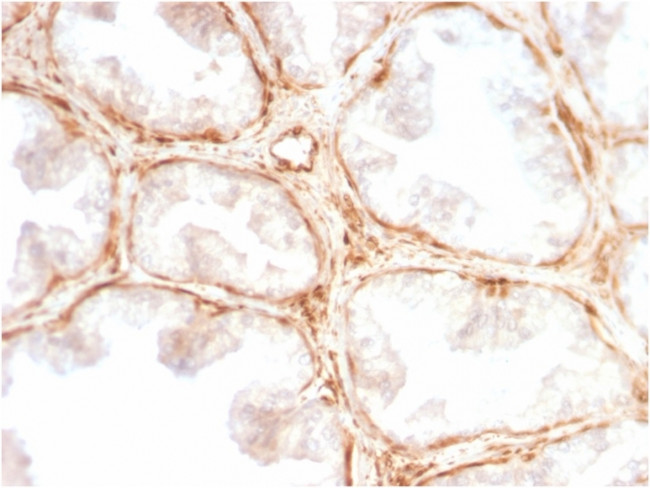 Galectin-1/Human Placental Lactogen (hPL) Antibody in Immunohistochemistry (Paraffin) (IHC (P))