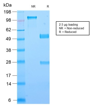 Galectin-1/Human Placental Lactogen (hPL) Antibody in SDS-PAGE (SDS-PAGE)