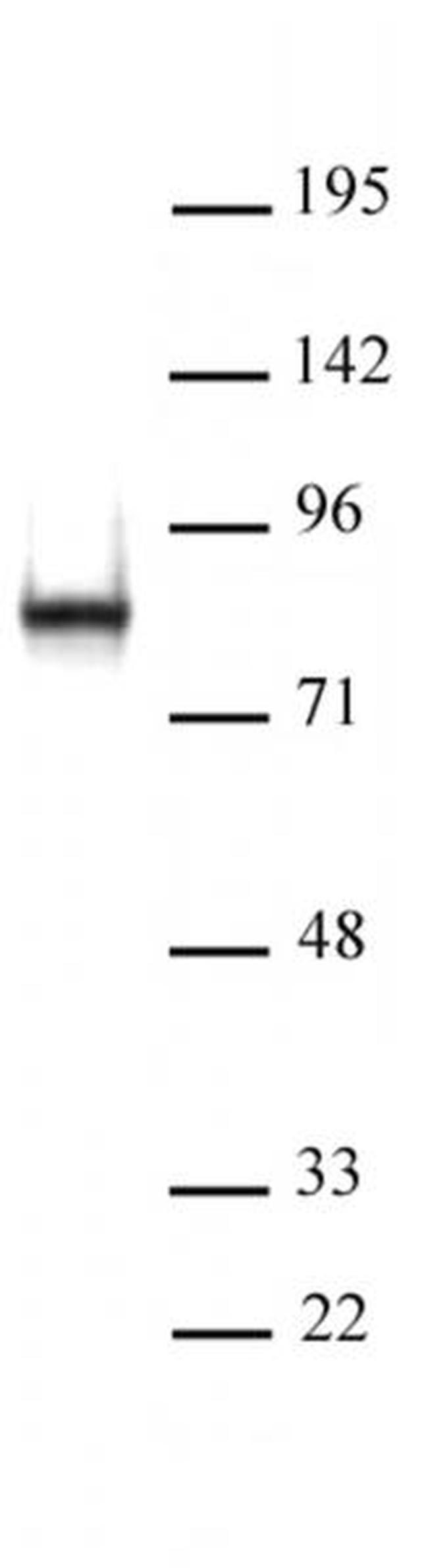 L3MBTL2 Antibody in Western Blot (WB)