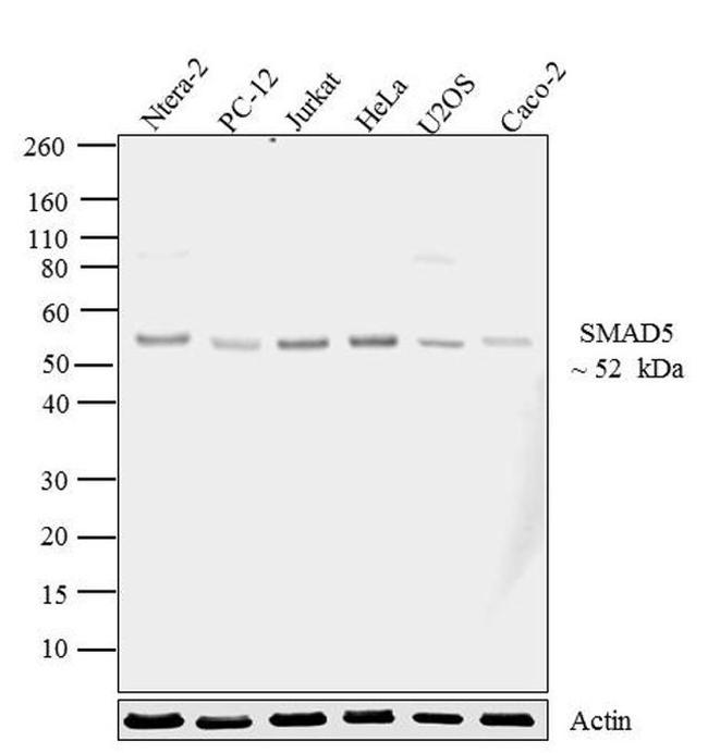 SMAD5 Antibody in Western Blot (WB)