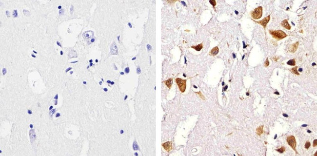 SMAD5 Antibody in Immunohistochemistry (Paraffin) (IHC (P))