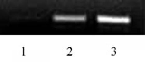 Histone H2BK46ac Antibody in ChIP Assay (ChIP)