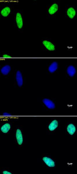 Histone macroH2A1 Antibody in Immunocytochemistry (ICC/IF)