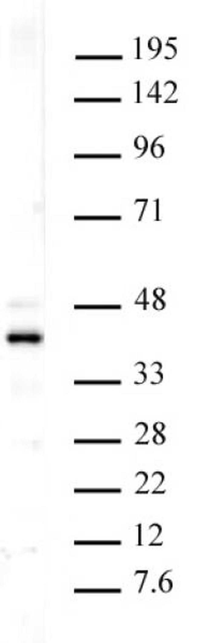 Histone macroH2A1 Antibody in Western Blot (WB)