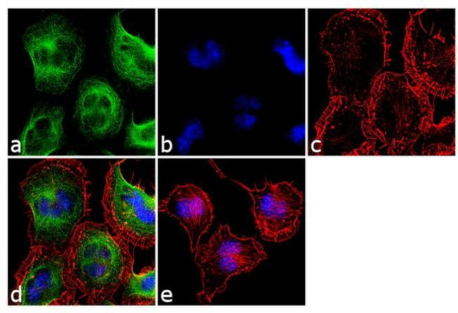 TACR1 Antibody in Immunocytochemistry (ICC/IF)