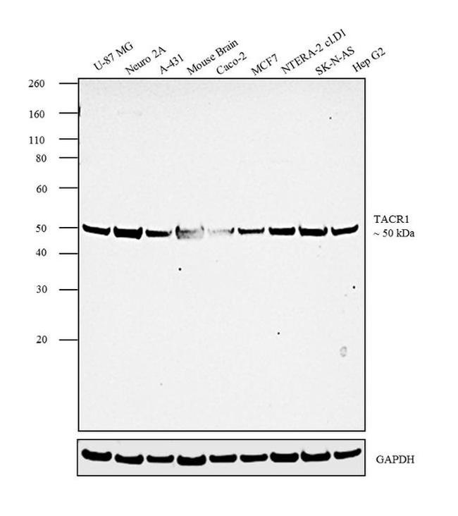 TACR1 Antibody in Western Blot (WB)