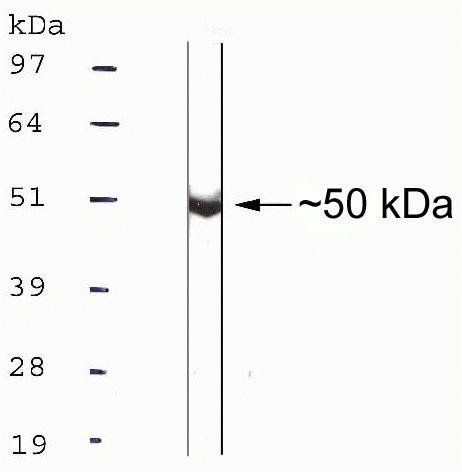 TACR1 Antibody in Western Blot (WB)