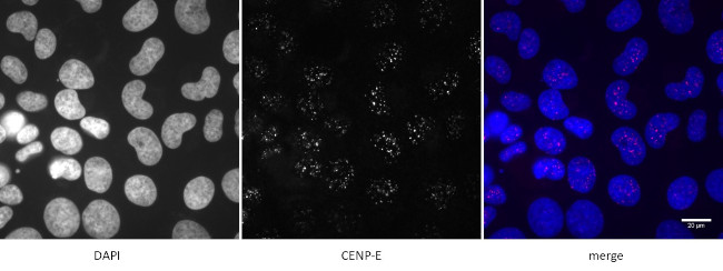 CENP-E Antibody in Immunocytochemistry (ICC/IF)