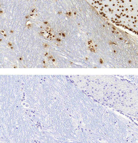 5-Methylcytosine (5-mC) Antibody in Immunohistochemistry (IHC)