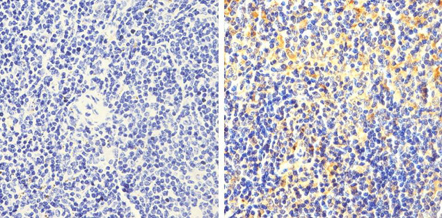 FAK Antibody in Immunohistochemistry (Paraffin) (IHC (P))