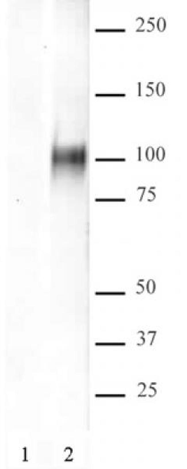 HIF-1 alpha Antibody in Western Blot (WB)